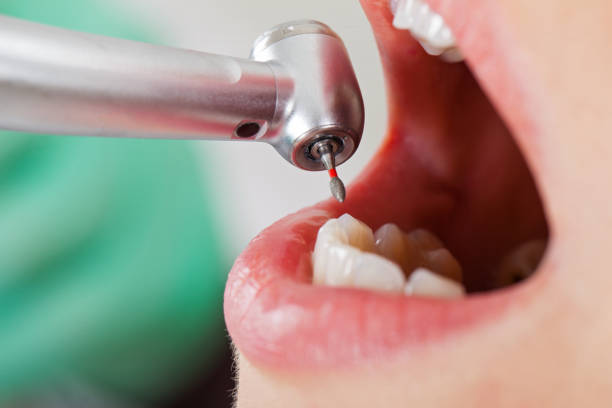 Best Pediatric Emergency Dentist in Edgard, LA